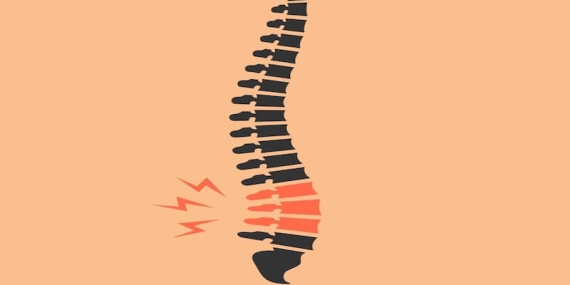 Bel Fıtığı Ameliyatında Epidural Anestezi: Güvenli ve Etkili Bir Yöntem